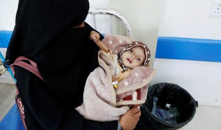 Yemen’de öldürülen ve sakatlanan çocuk sayısı 10 bini geçti
